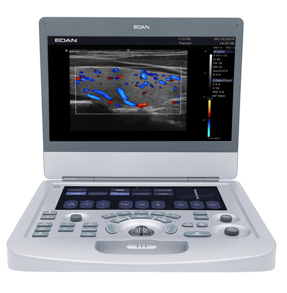 Edan AX3 Ultrasound