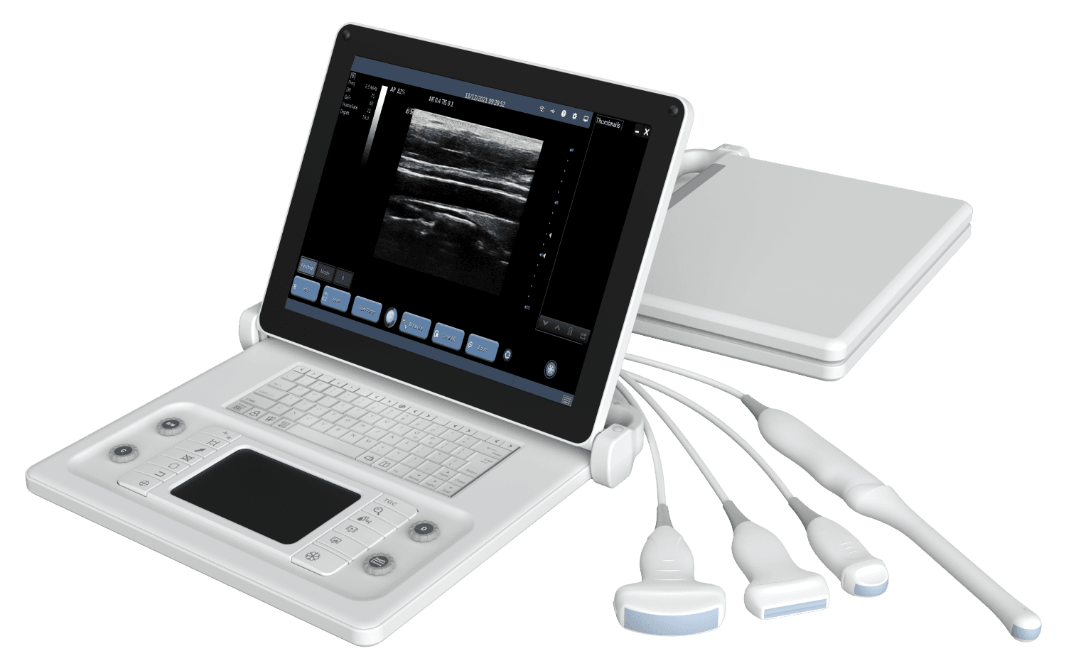 F6 Portable color Doppler ultrasound diagnostic instrument